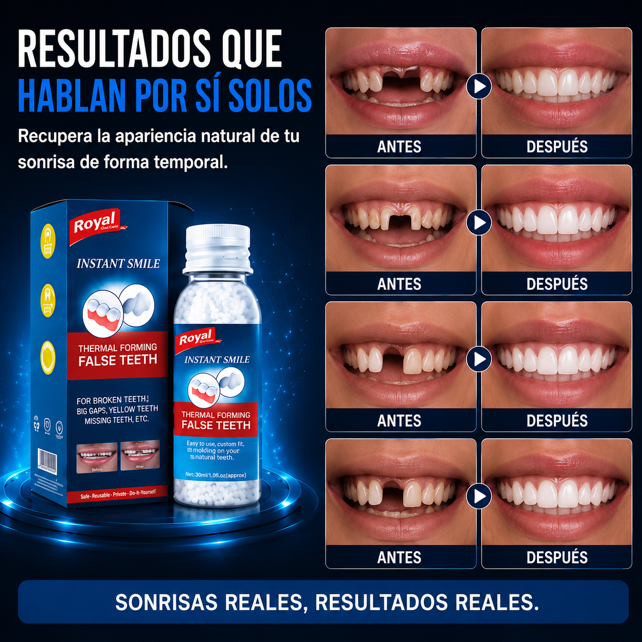 Dental Glue™ Pro - Pegamento Dental Moldeable
