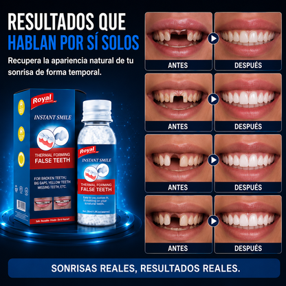 Dental Glue™ Pro - Pegamento Dental Moldeable
